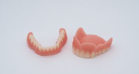 Upper and lower 3D printed dentures from 3D Systems. Photo via 3D Systems.