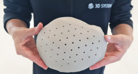 The VSP PEEK Cranial Implant is the first FDA-cleared, additively manufactured PEEK implant intended for cranioplasty procedures to restore defects in the skull. Photo via 3D Systems.